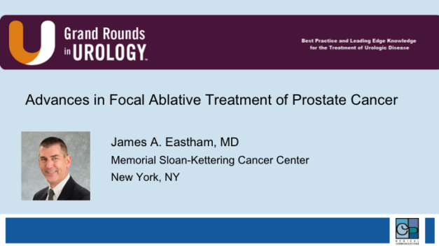 Advances in Focal Ablative Treatment of Prostate Cancer