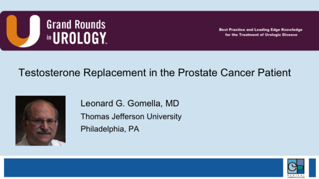 Testosterone Replacement in the Prostate Cancer Patient