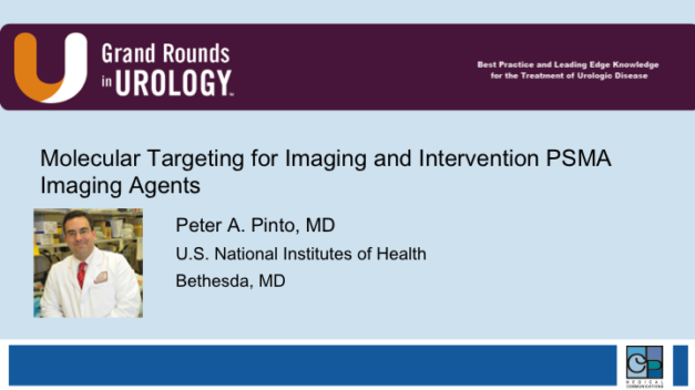 Molecular Targeting for Imaging and Intervention PSMA Imaging Agents