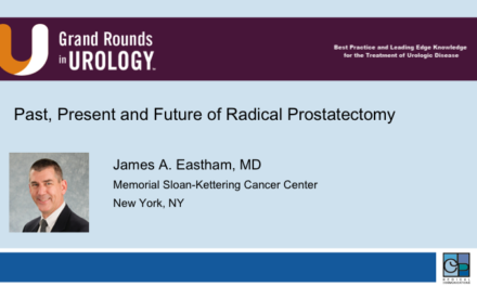 Past, Present and Future of Radical Prostatectomy