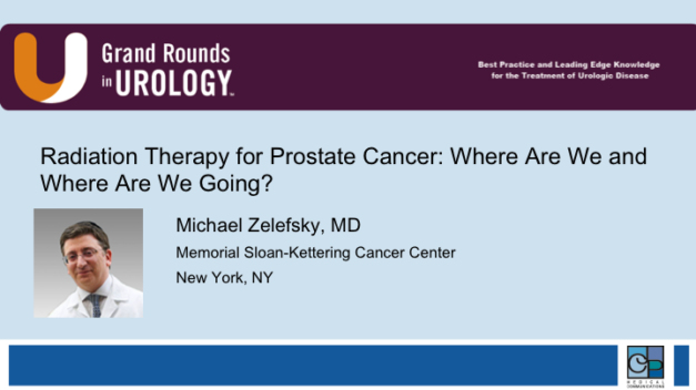 Radiation Therapy for Prostate Cancer: Where Are We and Where Are We Going?