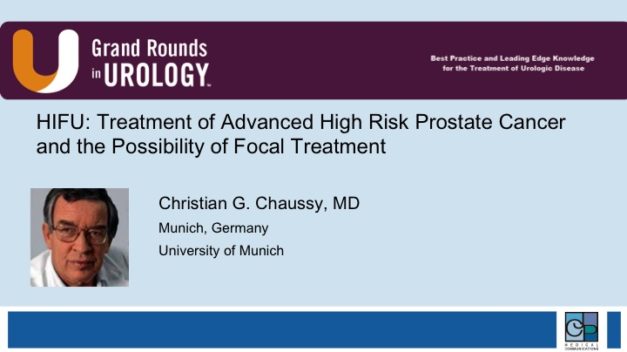 HIFU: Treatment of Advanced High Risk Prostate Cancer and the Possibility of Focal Treatment