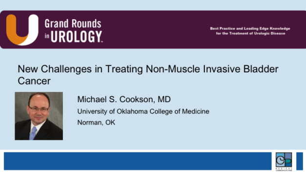New Challenges in Treating Non-Muscle Invasive Bladder Cancer