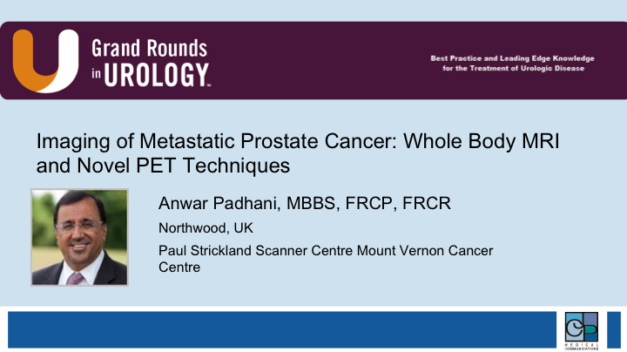 Imaging of Metastatic Prostate Cancer: Whole Body MRI and Novel PET Techniques