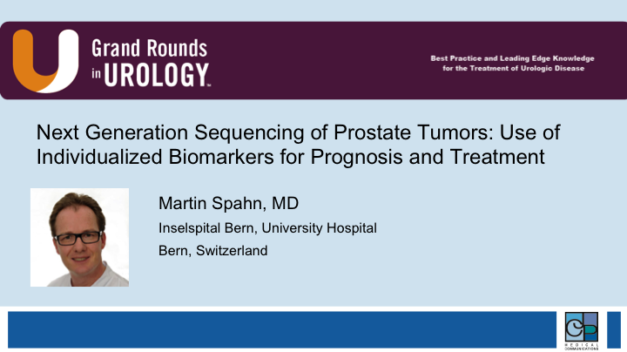 Next Generation Sequencing of Prostate Tumors: Use of Individualized Biomarkers for Prognosis and Treatment