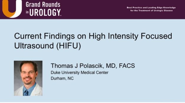 Current Findings on High Intensity Focused Ultrasound (HIFU)
