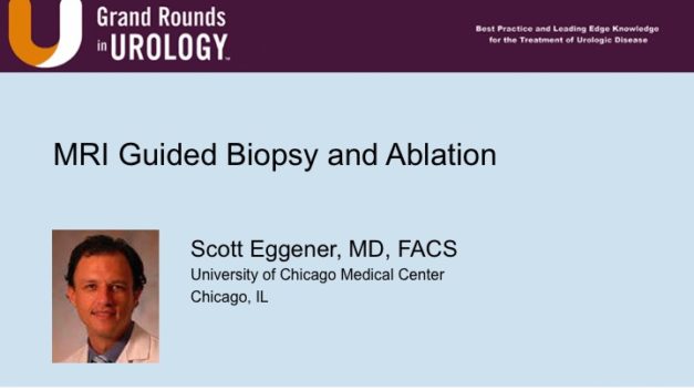 MRI Guided Biopsy and Ablation