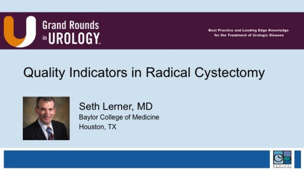 Quality Indicators in Radical Cystectomy