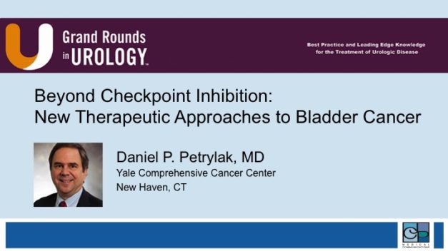 Beyond Checkpoint Inhibition: New Therapeutic Approaches to Bladder Cancer