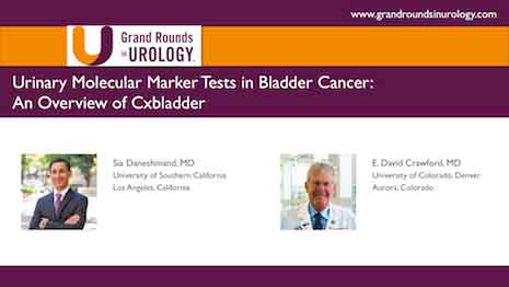 Urinary Molecular Marker Tests in Bladder Cancer: An Overview of Cxbladder