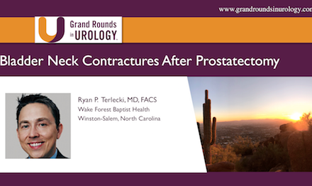 Bladder Neck Contractures After Prostatectomy