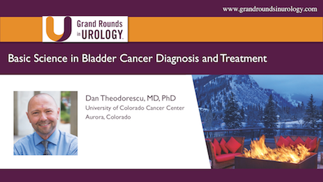 Basic Science Foundations of Bladder Cancer Diagnosis and Treatment