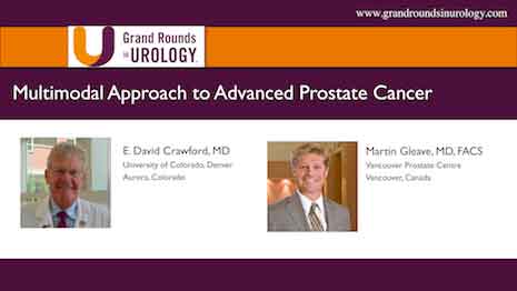 Multimodal Approach to Advanced Prostate Cancer