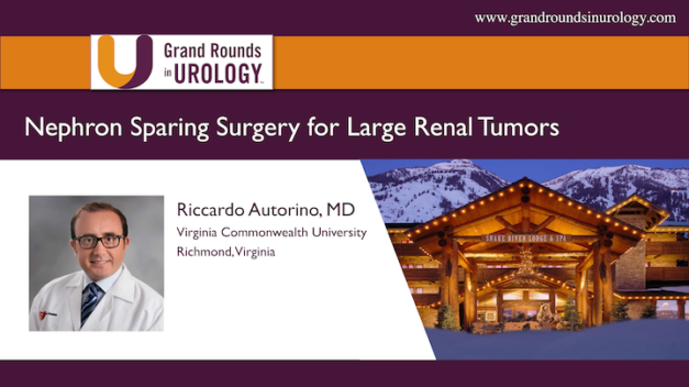 Nephron Sparing Surgery for Large Renal Tumors: Always, Sometimes, or Never?