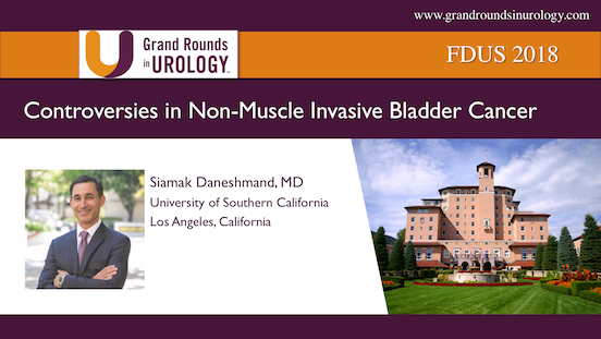 Controversies in Non-Muscle Invasive Bladder Cancer
