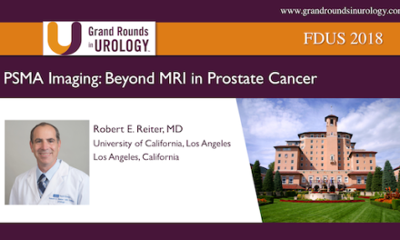 PSMA Imaging: Beyond MRI in Prostate Cancer