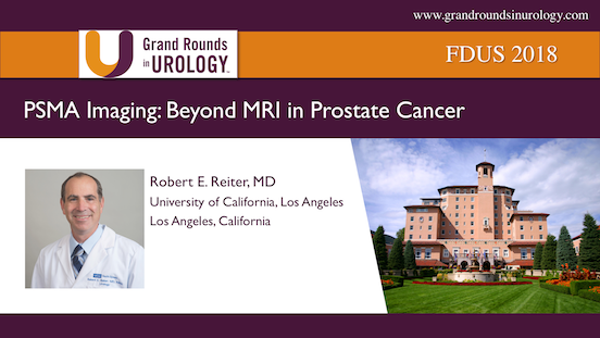 PSMA Imaging: Beyond MRI in Prostate Cancer
