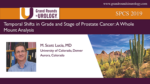 Temporal Shifts in Grade and Stage of Prostate Cancer: A Whole Mount Analysis