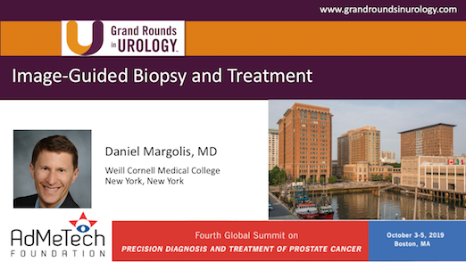 Image-Guided Biopsy and Treatment