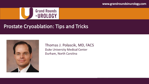 Prostate Cryoablation: Tips and Tricks