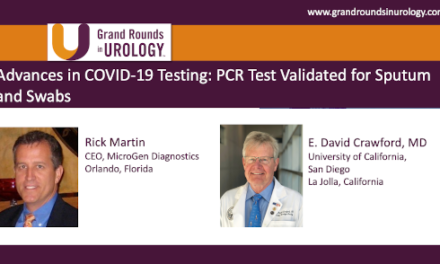 Advances in COVID-19 Testing: PCR Test Validated for Sputum and Swabs