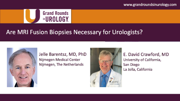 Are MRI Fusion Biopsies Necessary for Urologists?