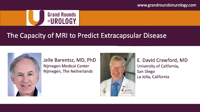 Dr. Barentsz - MRI Extracapsular Disease