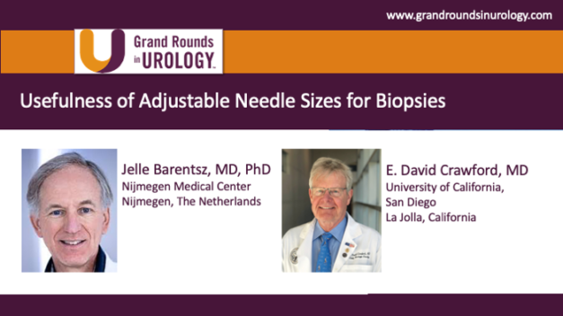 Usefulness of Adjustable Needle Sizes for Biopsies