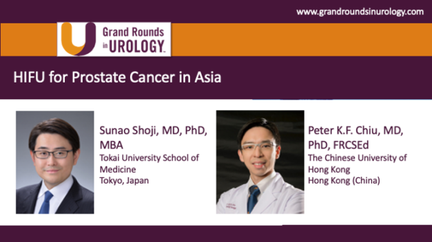 HIFU for Prostate Cancer in Asia