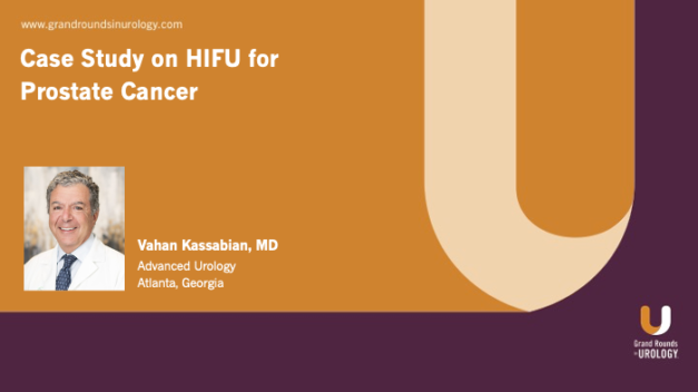 Case Study on HIFU for Prostate Cancer