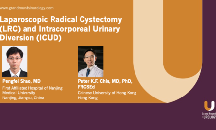 Laparoscopic Radical Cystectomy (LRC) and Intracorporeal Urinary Diversion (ICUD)
