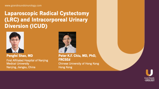 Laparoscopic Radical Cystectomy (LRC) and Intracorporeal Urinary Diversion (ICUD)